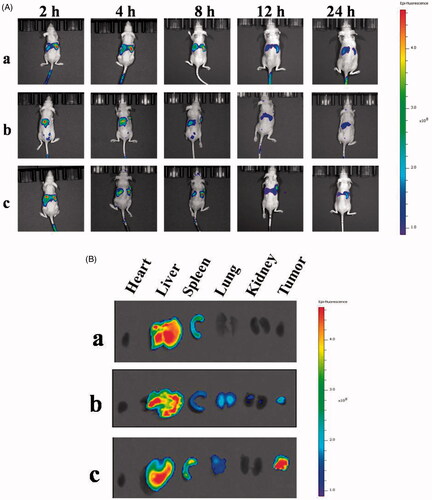 Figure 11. (A) In vivo small animal imaging of mice bearing PANC-1 cells with different DiR preparations. (B) The results of the distribution of organs and tumors in mice after 4 h. (a: free DiR, b: DHPA-CDB/DiR, c: oHA-PBA@DHPA-CDB/DiR).