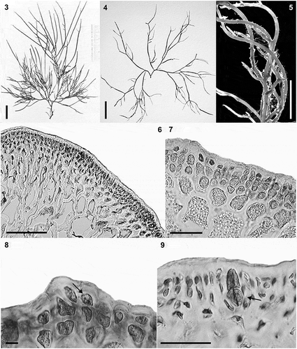 Figs 3–9. Habit and anatomical morphology of Crassiphycus secundus. Figs 3–5. Range of habit variation and degree of branching. Fig. 3. Crassiphycus secundus type deposited in BM. Fig. 4. Voucher specimen from Capron Shoal, Fort Pierce, Florida, USA (LAF 07.98; rbcL GenBank accession number: AY049356). Fig. 5. Voucher specimen depicting a drift specimen collected at the beach behind Harbor Branch Oceanographic Institution, Indian River, Fort Pierce, Florida, USA (LAF 07.18.98.01.01; rbcL GenBank accession number: AY049361). Figs 6–9. Cross section from specimens collected in Cockroach Bay, Tampa Bay area, Florida, USA (LAF 26.10.99.01.04; rbcL GenBank accession number: AY049360). Fig. 6. Cross section showing gradual cell size transition between cortex and medulla. Fig. 7. Cross section showing detail of the transition between cortex and medulla, note extensive amount of floridean starch. Fig. 8. Cross section showing detail of cortical cells with oblique division of outer cortical cells (arrow). Fig. 9. Cross section showing mature cruciately divided tetrasporangium (arrow). Scale bars = 2 cm (Fig. 3), 4 cm (Fig. 4), 0.5 cm (Fig. 5), 100 µm (Fig. 6), 40 µm (Figs 7 & 9), 4.5 µm (Fig. 8)