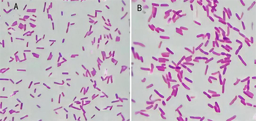 Figure 3 Gram-stained morphological observations of two pathogenic bacteria under the microscope. (A) Haemophilus aphrophilus is a small Gram-negative bacillus. (B) Eikenella corrodens is similar in morphology to H. aphrophilus, except that the organism is slightly larger.
