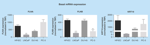 Figure 1.  Basal mRNA expression of biomarkers in prostate cancer cells.Expression was assessed by quantitative RT-PCR and normalized to TBP. Data represent means + SEM, N = 3. * p < 0.05, ** p < 0.01 and *** p < 0.001 compared with HPrEC. HPrEC: Normal, human, primary prostate epithelial cells; FLNA: Filamin-A; FLNB: Filamin-B; KRT19: Keratin-19; RT-PCR: Real-time PCR; SEM: Standard error of the mean; TBP: TATA-binding protein.