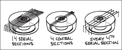 Figure 27. Reducing the amount of sections