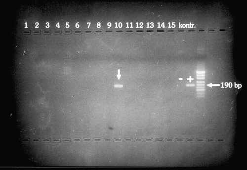 Fig. 1 Agarose gel demonstrating PCR detection of Borrelia burgdorferi s.l. DNA in passerine bird blood.