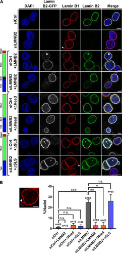 FIG 3 The SLSATGR sequence in the lamin B2 tail domain maintains nuclear morphology. (A) Immunofluorescence staining of lamin B1, showing the nuclear morphology in control and lamin B2-depleted cells overexpressing full-length lamin B2-GFP (+LMNB2), (ii) lamin B2ΔHead (+ΔHead), and (iii) lamin B2ΔSLS (+ΔSLS) constructs. Control cells show ellipsoidal nuclei with uniform lamin B1 staining at the nuclear periphery. Lamin B2-depleted cells show nuclear blebs that partially stain for lamin B1 (arrowhead). Scale bars, ∼5 μm. (B) The incidence of nuclear blebs in lamin B2 depleted cells was reduced upon overexpression of full-length lamin B2 (siLMNB2+LMNB2) and lamin B2ΔHead (siLMNB2+ΔHead) but not upon overexpression of lamin B2ΔSLS (siLMNB2+ΔSLS). (*, P < 0.05; **, P < 0.01; ***, P < 0.001 [by Student's t test]) (number of independent biological replicates [N] = 3; n, number of nuclei). Error bars indicate SEM.