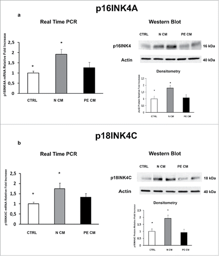 Figure 5. P16INK4A and p18INK4C gene and protein expression levels in physiological placental villous explants treated with culture media conditioned by normal or PE-PDMSC. (A) P16INK4A mRNA (left panels) and protein (right panels) expression levels in physiological villous explants treated with unconditioned media (CTRL, n = 16 explants) or media conditioned by normal (N CM, n = 16 explants) and preeclamptic (PE CM, n = 16 explants) PDMSCs as assessed by Real Time PCR and Western Blot analysis. B) and p18INK4C mRNA (left panels) and protein (right panels) expression levels in physiological villous explants treated with unconditioned media (CTRL, n = 16 explants) or media conditioned by normal (N CM, n = 16 explants) and preeclamptic (PE CM, n = 16 explants) PDMSCs as assessed by Real Time PCR and Western Blot analysis. Statistical significance (*) has been considered as p < 0.05.