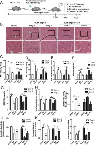 Figure 1. Gln alleviates tissue injury, promotes redox balance, and restores ATP generation in the liver of burn septic mice. (A) Time flow of burn sepsis model construction and treatment process. (B-D) The pathological changes of mouse liver at 3 and 5 days with or without Gln treatment for burn sepsis (B), and changes in ALT (C) and AST (D) levels in peripheral blood of burn septic mice with or without Gln treatment. (E-K). Changes in malondialdehyde (E), myeloperoxidase (F), superoxide dismutase (G), catalase (H), mitochondrial complex I (I), mitochondrial complex II (J), and mitochondrial complex III (K) activities in liver at 3 and 5 days with or without Gln treatment for burn sepsis. (L) Changes in ATP levels in liver at 3 and 5 days with or without Gln treatment for burn sepsis. n ≥ 3 per group (Sham: n = 8, BS3: n = 4; BS5: n = 3; BS3 + G: n = 5; BS5 + G: n = 5), * P < 0.05, ** P < 0.01, Scale bar: 50 μm. Sham: sham burn group, BS (Burn Sepsis): burn sepsis group, BS + G (Burn Sepsis + Gln): burn sepsis + glutamine group.