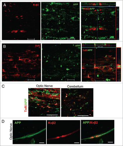 Figure 1. APP localizes at nodes of Ranvier in the CNS, but not in the PNS. (A and B) The longitudinal sections of spinal cord of 2-mo-old rat were stained for APP (A and B) and Kvβ2 (A) or tenascin-R (TnR; B). The Z-stack confocal images were showed in the right panels. Scale bars: 10 μm. (C) The longitudinal sections of optic nerves and cerebellum of 2-mo-old rat were stained for APP and tenascin-R (TnR). Scale bar: 20 μm. (D) The teased sciatic nerve were stained for APP and neurofilament200 (NF200) or Kv1.2. Scale bars: 10 μm.