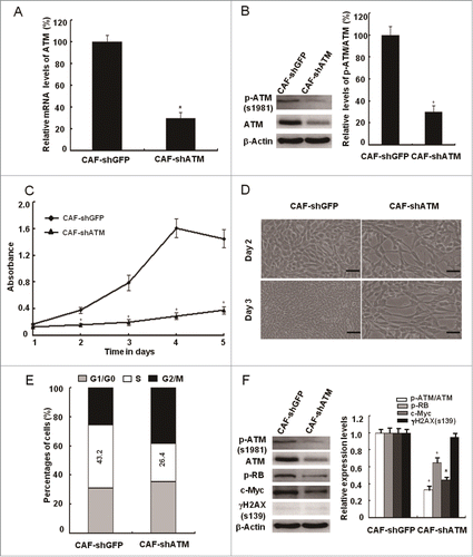 Figure 5. siRNA-mediated knockdown of ATM suppresses the breast CAFs proliferation. (A, B) The knockdown efficiency of the ATM gene by shRNA in CAFs was testified with qRT-PCR and Western Blot (*, P < 0.05, CAF-shGFP vs CAF-shATM). (C) Growth curves of CAF-shGFP and CAF-shATM were analyzed with the MTT assay for 5 d (*, P < 0.05, CAF-shGFP vs CAF-shATM at the designed time points). (D) The cell growth density of CAF-shGFP and CAF-shATM for 2 d or 3 d was displayed by Photomicrographs. Scale bars, 50 μm. (E) Flow cytometry analyses of CAF-shGFP and CAF-shATM. (F) Immunoblotting analyses were performed with the indicated antibodies in both CAF-shGFP and CAF-shATM (*, P < 0.05, CAF-shGFP vs CAF-shATM).