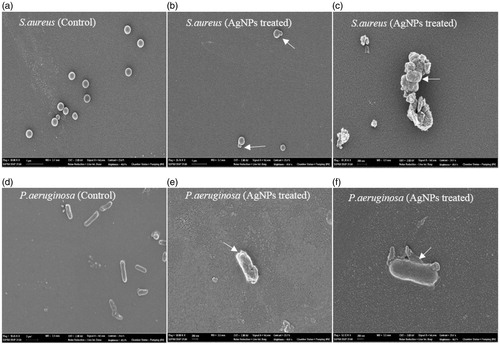 Figure 7. SEM observation of bacterial cells treated with AgNPs. The bacterial cells treated with AgNPs caused rupture of bacterial cell wall and shrinkage in cell shapes (Arrows indicate membrane blebbing and change in cell shapes). Whereas the untreated cells showed a rigid rod and cluster shaped cells without any changes on their surface.