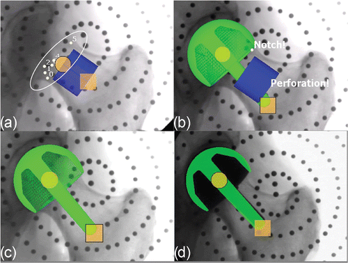 Figure 3. (a) Safe zone definition. (b) Warning during implant alignment. (c) Final implant position. (d) Offset between planning and result. [Color version available online.]