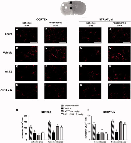 Figure 8. Effect of sub-chronic treatment with ACTZ and AN11-740 on astrocytes alteration in cortex and striatum 24 h after pMCAo. Upper part: Representative photomicrograph of a coronal section (at Bregma = 0Citation36) showing the ischaemic area in a vehicle-treated rat. The two white and black squares indicate regions within the ischaemic area and within the perischemic area, respectively, where photomicrographs were captured. Scale bar = 2 mm. (A–P) representative microphotographs of astrocytes (red) in cortical ischaemic and perischemic areas and in striatal ischaemic and perischemic areas of sham-operated (A, B; I, J, n = 3), vehicle- (C, D; K, L, n = 3) ACTZ- (E, F; M, N, n = 4) and AN11-740- (G, H; O, P, n = 3) treated rats. Scale bar = 50 µm. (Q, R) Quantitative analysis of GFAP+ cells in cortical and striatal ischaemic and perischemic areas, bar graphs represent mean ± SEM of the number of astrocytes per optical field (20×). One-way ANOVA followed by Newman–Keuls post hoc test: #at least p < 0.05 vehicle-treated vs. sham-operated rats; **at least p < 0.01 ACTZ- and AN11-740- vs. vehicle-treated rats.