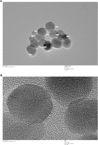 Figure 1 Characterization of iron oxide nanoparticles. (A) Transmission electron microscope (TEM) images of IONPs depicting the shape and size of nanoparticles. Scale bar size, 20 nm. (B) Crystal lattice image of IONPs; bar size of 1 nm. Analysis was performed at 200 kV.