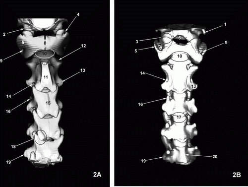 Figure 2.  Three-dimensional (3D) reconstructed CT image of the cervical spine viewed from the dorsal (A) and ventral (B) aspect. 1. Paracondylar process of occipital bone (ventral view only). 2. Occipital condyles (dorsal view only). 3. Atlantooccipital joint (ventral view only). 4. Notch alaris (dorsal view only). 5. Wing of atlas. 6. Foramen magnum (ventral view only). 7. Fossa Atlantis (ventral view only). 8. Dorsal tubercle of atlas (dorsal view only). 9. Transverse foramen of atlas. 10. Dens of axis and atlantoaxial joint. 11. Spinous process of axis (dorsal view only). 12. Cranial articular process of axis. 13. Transverse process of axis. 14. Transverse foramen of axis. 15. Spinous process of third cervical vertebra (dorsal view only). 16. Ventral tubercle of transverse process of third vertebra. 17. Joint between vertebral bodies. 18. Joint between articular processes. 19. Dorsal tubercle of transverse process of fifth vertebra. 20. Ventral crest of fifth vertebra (ventral view only).