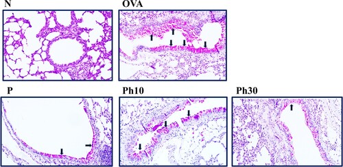 Figure 5. Effects of phillyrin (Ph) on goblet cell hyperplasia in lung tissue. Lung sections were stained with periodic acid-Schiff (PAS) stain. Arrows indicate goblet cells. N, Normal group; OVA, OVA-induced asthma group; Ph10, group treated with 10 mg/kg phillyrin; Ph30, group treated with 30 mg/kg phillyrin; P, group treated with 5 mg/kg prednisolone.
