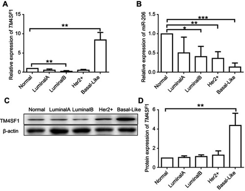 Figure 1 Upregulation of TM4SF1 and downregulation of miR-206 in clinical  breast cancer tissues compared with the levels in adjacent normal breast tissues.Notes: The mRNA expression of TM4SF1 (A) and miR-206 (B) was detected by real-time PCR in four subtypes of clinical breast cancer (Luminal A, Luminal B, Her2+, and basal like. N=5 for each subtype). (C) Western blotting analysis of TM4SF1 expression in four subtypes of clinical breast cancer. β-Actin served as the internal control. (D) The relative fold change of TM4SF1/β-actin in (C) was detected by imageJ software. *P<0.05; **P<0.01; ***P<0.001.Abbreviations: TM4SF1, transmembrane 4 L6 family member 1; miR-206, microRNA-206.