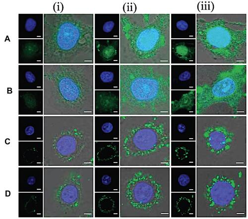 Figure 5 CLSM images of MSNs-TAT with diameters of (A) 25, (B) 50, (C) 67, and (D) 105 nm after incubation with Hela cells for (i) 4, (ii) 8, and (iii) 24 h. Scale bars: 5 μm.