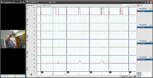 Figure 5 LabChart® display window.