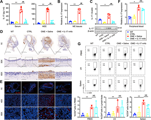 Figure 5 Anti-IL17 mAb neutralized IL-17 and attenuated IL-17-induced inflammation. (A) IL-17 levels in the serum and MEE were detected by ELISA. The error bars represent the s.e.m. of five rats per group. (B and C) The expression of IL-17 in the middle ear (ME) tissues was measured by qPCR, Western blot. The error bars represent the s.e.m. of three pairs of ears per group. (D) IL-17 expression (brown) was determined by the immunohistochemistry at 1×, 30×, 60× magnification. (E) IL-17 expression (brown) was determined by the immunofluorescence analysis at 1×, 40×, 60× magnification. IL-17 (red), DAPI (blue). (F) qPCR was used to measure IL-17 expression in the immune cells of the peripheral blood. The error bars represent the s.e.m. of three rats per group. (G) Flow cytometry was used to assess the IL-17 expression of CD4+ T-cells in the peripheral blood mononuclear cell (PBMC), lymph node (LN), and spleen, and the IL-17 expressing cells were gated from CD4+ T cell subset as shown in Figure S1. The error bars represent the s.e.m. of three rats per group. *P < 0.05, **P < 0.01, ##P < 0.01. Data are representative of three independent experiments.