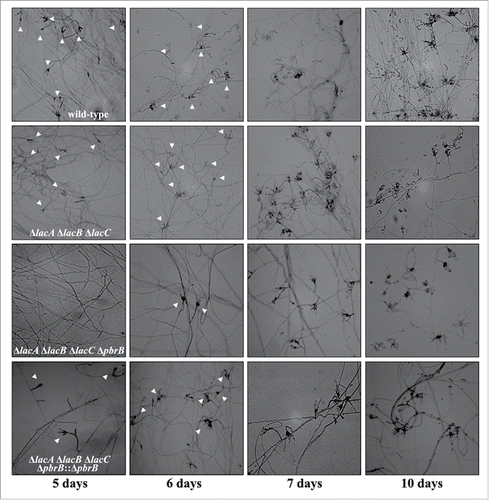 Figure 4. Representation of differences in density of conidiophores observed on slide cultures. Conidia of wild-type G681, ΔpbrB, ΔlacA ΔpbrB, ΔlacA ΔpbrB ΔlacC, ΔlacA ΔpbrB ΔlacC ΔpbrB, ΔlacA ΔpbrB ΔlacC ΔpbrB::pbrB were cultured on ANM agar and incubated in a moist chamber at 28°C for 5, 6, 7, and 10 days. Unlike other strains, ΔlacA ΔpbrB ΔlacC ΔpbrB produces very few conidiophores on day 5 to 6. Slide cultures were examined under the microscope for conidiophores. Images shown are at 100X magnification. White triangles point to conidiophores. The data represents the results of 2 independent experiments performed in duplicate.