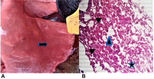 Figure 4 Grossly, depressed areas on the surface of the lung (yellow arrow) (A). Microscopically, lung section showing slit-like collapsed alveoli with narrow alveolar space and lumina (star), emphysematous foci (triangle) and thickened alveolar septa (arrow heads) H&E ×10 (B).