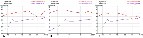 Figure 2 Frequency spectra of sound pressure levels measured using the original stethoscope. (A) Measured at the triangle of auscultation of the lungs. (B) measured at the apex area of the heart. (C) measured at McBurney’s point of the intestines.