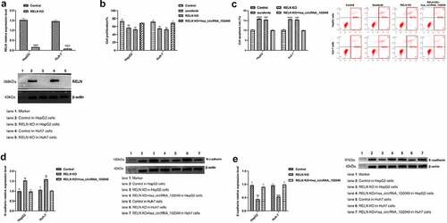 Figure 8. Hsa_circRNA_102049 reversed the sorafenib resistance of RELN knockout HCC cells. a. The expression of RELN in RELN gene knocking out HepG2 cells and Huh-7 cells were detected by Western blot b. The proliferation ability of HepG2 cells and Huh-7 cells transfected with Control, RELN knockout (KO), RELN KO+hsa_circRNA_102049 were detected by CCK-8 assay. c. The apoptosis rate of HepG2 cells and Huh-7 cells transfected with Control, RELN knockout (KO), RELN KO+hsa_circRNA_102049 were detected by flow cytometry. d. The expression level of RELN, N-cadherin and E-cadherin proteins in HepG2 cells and Huh-7 cells transfected with Control, RELN KO, RELN KO+hsa_circRNA_102049 were detected by Western blot. *p < 0.05, **p < 0.01, ***p < 0.001, compared to the Control.