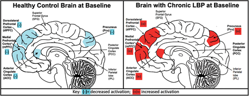 Figure 3. Conceptual map of a healthy control brain activation and a brain with chronic low.