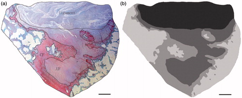 Figure 4. The contour lines drawn manually and image processing. Scale bar = 1 mm. (a) The four zones were distinguished according to their histomorphology, and the staining and the contour lines were drawn manually. (b) The two-dimensional images were filled with different gray values.