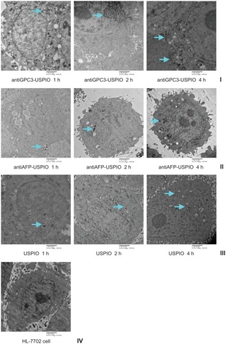 Figure 3 Hitach 7600 TEM demonstrates iron oxide incorporation by HPG2 cells (I–III) and HL-7702 hepatocytes for antiGPC3-USPIO, antiAFP-USPIO or USPIO nanoparticles in a time-dependent manner with a magnification of 10,000. The USPIO nanoparticles scattered around the cell membrane and cytoplasma after the HPG2 cells incubated with iron content of 750 μg/mL for 1 h. For 2 h and 4 h the amount of USPIO nanoparticles incorporated into intracellular increased and fused gradually, and became masses. No USPIO nanoparticle was seen in the HL-7702 hepatocytes during incubation of 1 h, 2 h and 4 h (IV).Note: The arrow indicates the USPIO nanoparticles.Abbreviations: USPIO, ultrasuperparamagnetic iron oxide nanoparticle; antiGPC3 USPIO: the probe was formed using antiglypican-3 monoclonal antibodies coupled with USPIO nanoparticles; antiAFP-USPIO: the probe was formed using antiAFP antibodies coupled with USPIO nanoparticles.