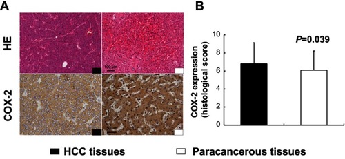 Figure 1 Expression of COX-2 in human hepatocellular carcinoma (HCC) tissues and paracancerous tissues. Immunohistochemistry (IHC) for COX-2 displayed cytoplasmic expression of hepatocytes in both HCC tissues and paracancerous tissues (A). There was a significant difference in the expression levels of COX-2 between human HCC tissues and paracancerous tissues (B, P=0.039, n=95). Scale bar =100 µm for HE staining; scale bar =50 µm for IHC staining.