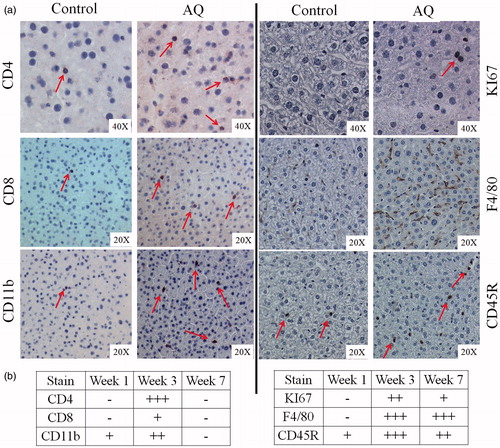 Figure 5. Immunohistochemical staining of livers from female C57BL/6 mice. (a) Staining for CD4, CD8, CD11b, KI67, F4/80, or CD45R. (b) Grading of the number of cells in (a); grading is based on the results of statistical analysis from Figure S2. Figures are representative of four animals/group. For illustration purposes, slides from mice treated with AQ for 3 weeks are shown as they showed the greatest changes.