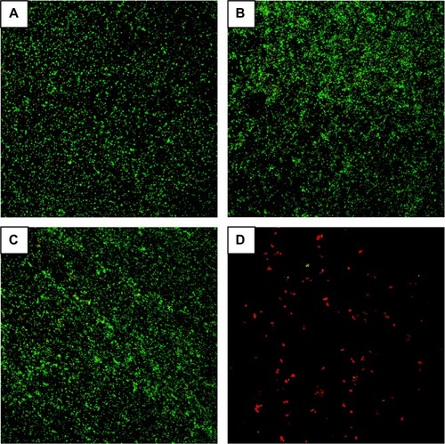 Figure 6 Fluorescence microscopy images showing viability of the adherent Staphylococcus aureus on the specimens, as displayed by SYTO® 9 and propidium iodide dyes. (A) polished cp-Ti. (B) MAO-Ti. (C) PLLA-MAO-Ti. (D) BBF/PLLA-MAO-Ti.Abbreviations: BBF/PLLA-MAO-Ti, cross-linking (Z-)-4-bromo-5-(bromomethylene)-2(5H)-furanone loaded poly(L-lactic acid) nanoparticles with gelatin on microarc-oxidized titanium; cp-Ti, commercially pure Ti; MAO-Ti, microarc-oxidized titanium; PLLA-MAO-Ti, cross-linking poly(L-lactic acid) nanoparticles with gelatin on microarc-oxidized titanium.