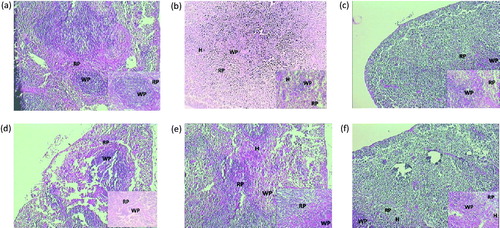 Figure 6. Histological alteration of spleen in mice: (a) the normal group shows intact white and red cell pulps. (b) The AR control group shows the complete disruption in white and red pulp cells, hyperplasia is observed. (c) Montelukast (10 mg/kg) group shows more protective effect on red and white pulps and less hyperplasia is observed. (d) PIP (10 mg/kg) shows protective effect on red and white pulp cells. (e) PIP (20 mg/kg) shows more protection of both cells and intact structure with less hyperplasia. (f) PIP (40 mg/kg) total protection of both pulp and hyperplasia is not observed. RP, red pulp; WP, white pulp; H, hyperplasia; PIP, piperine; Monte, montelukast. Figure in parentheses indicates dose in mg/kg, p.o. (40 × ).