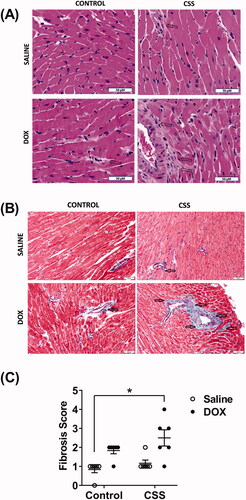 Figure 5. Histopathologic evaluation of myocardial fibrosis and inflammation in hearts from male C57BL/6N mice. Male 5-week old C57BL/6N mice were administered DOX (4 mg/kg/week) or saline for 3 weeks and allowed to recover for 5 weeks prior to exposure to CSS. Representative images from (A) hematoxylin and eosin (HE) and (B) Masson’s trichrome stained heart sections; bar scale = 50 µM. Inflammatory cell infiltration in (A) and fibrotic areas in (B) are indicated with arrows. (C) Semi-quantification of fibrosis score derived from Masson’s trichrome stain (n = 6 per group). Statistical analysis was determined by non-parametric Kruskal–Wallis followed by a Mann–Whitney tests (*p< .05).