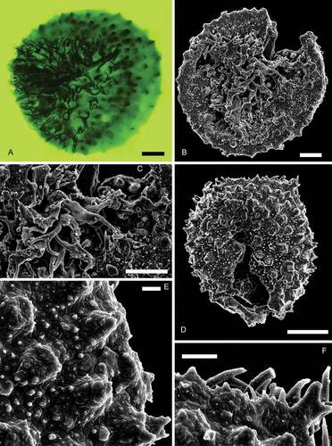 Figure 14. Nathorstisporites hopliticus Jung, Citation1958. Scale bars = 100 μm, or indicated otherwise. A. Proximal view, fluorescence, S066557, P36-2. B. Proximal view, SEM, Munkerup. C. Enlargement, SEM, Munkerup. Scale bar = 50 μm. D. Distal view, SEM, Munkerup. E. Enlargement, SEM, Munkerup. Scale bar = 10 μm. F. Enlargement, SEM, Munkerup. Scale bar = 20 μm