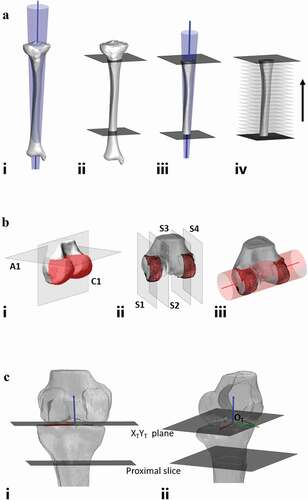 Figure 1. Workflow for development of coordinate system. A – longitudinal axis of tibia workflow. Ai – cone fit applied to full length tibia from proximal joint to distal joint establishing reference axis. Aii – user-selected slice made below tibial tuberosity along with computer generated slice 200 mm below initial slice, cone fit to be applied between two slices. Aiii – cone fit applied between two slices with axis established through center of cone. proximal and distal aspects of tibia discarded showing only section of tibia to which the cone fit is applied. the axis is represented as the blue line. Aiv – Successive discarding of 10 mm of tibial shaft to test application of cone at each changing shaft length. B – mediolateral axis of tibia workflow. Bi – reconstructed distal femur with automated slices made to isolate posterior aspect of femoral condyles (highlighted in red). Bii – sagittal slice made to outer aspect of each condyle isolating a condylar width of 12 mm. Biii – cone fit applied to initial condylar width showing direction of mediolateral axis. the axis is represented as the red line. C – coordinate system generation. longitudinal axis of tibia, ZT (blue), mediolateral axis of femur, XT (red) and orthogonal axis, YT (green). Ci – anterior view. Cii – lateral view