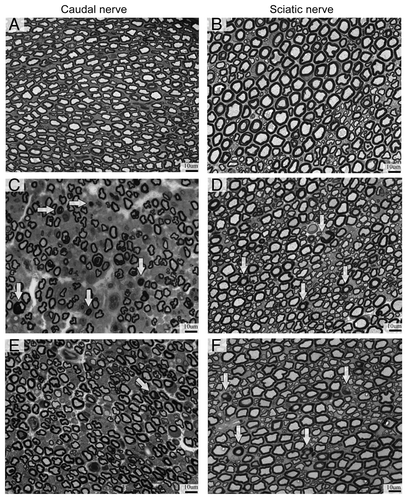 Figure 3. Light microscopy analysis. BTZ-induced morphological alteration in sciatic and caudal nerves. Axonal degeneration with loss of fiber density was evident in myelinated fibers of peripheral nerves, particularly in the caudal nerve at the end of BTZ treatment. CTRL (A and B), 8 wk-BTZ-treated (C and D) and follow-up rats (E and F). The arrows show axonal degeneration of myelinated fibers (scale bar = 10 μm).