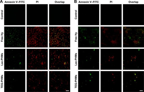 Figure 8 Laser scanning confocal microscope (LSCM) images of (A) HepG2 cells and (B) MCF-7 cells after Annexin V–FITC/PI staining.Notes: The cells were incubated with free Hy, Lac-PHMs, and TEG-PHMs for 4 hours at 37°C, respectively. After washing with PBS, they were exposed to the light, and then further cultured for 24 hours before Annexin V–FITC/PI staining. Scale bar: 50 μm.Abbreviations: Hy, hypericin; PHMs, hypericin-entrapped polydopamine–MNP composite nanoparticles; Lac-PHMs, lactose-modified PHMs; TEG-PHMs, triethylene glycol–modified PHMs; FITC, fluorescein isothiocyanate; PI, propidium iodide.