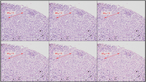 Figure 8. Overall configuration of the color discrimination evaluation method. The figure shows discrimination between the color of the cell nucleus within the granuloma and the color of the fibrous tissue outside the granuloma. Modulation was conducted so that the difference between the two colors near the center increased from left to right in the upper row and then left to right in the lower row.