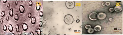 Figure 2. Phase contrast microscopy images: 2A FOL-DUAL-ILs; 2B FOL-DUAL-DLs; 2C UN-DUAL-DLs.