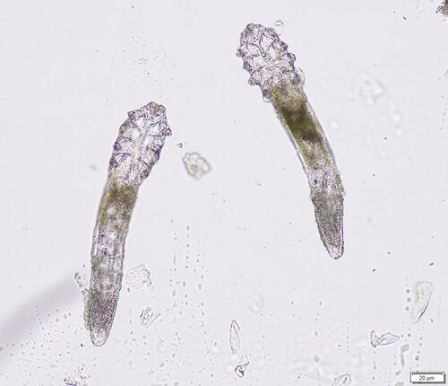 Figure 4 Demodex spp. from light microscopy.