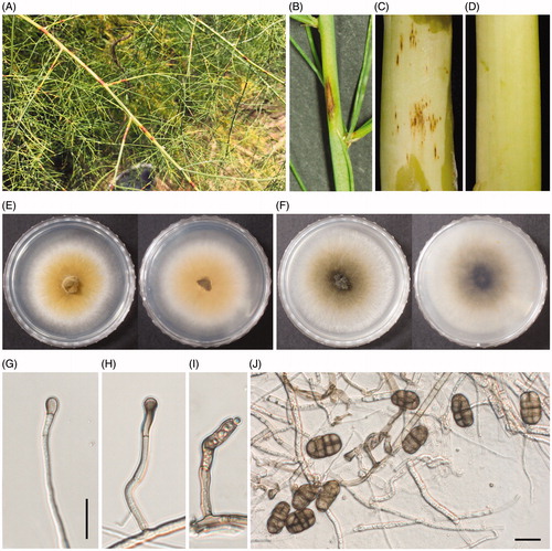 Figure 1. Purple spot caused by Stemphylium vesicarium on asparagus. (A) Symptoms of purple spot of asparagus ferns in field; (B,C) Signs of the causal fungus of purple spot on asparagus fern and spear by artificial inoculation; (D) Control of non-inoculation; (E,F) Fungal mycelial colonies on PDA and V8 juice agar plates (left, front view; right, back view); (G–I), Conidiophores; and (J) Morphological characteristics of conidia. Scale bars = 10 µm.