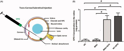 Figure 1. (A) The subretinal delivery pathway of EPO. A 30½-gague beveled needle was used to make an incision near the corneal limbus. The syringe needle of a Hamilton micro injector was inserted into the anterior chamber through the corneal perforation. The plunger of the Hamilton syringe was slowly pushed to deliver the EPO into the subretinal cavity. A successful subretinal injection would cause one or more retinal blebs on which retinal blood vessels were visible. (B) The retinal EPO level of the treated group was significantly higher than the normal controls. The retinal EPO level of the treated group was also significantly higher than the MNU group. The retinal EPO level of the Normal + EPO group was significantly higher than the normal controls (#p < .01 for differences compared between animal groups; All the values were presented as mean ± SD).