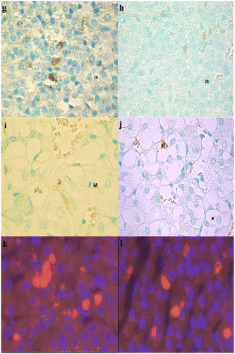 Figure 9. Pictures of TUNEL positive nuclei in the adrenal cortex and medulla and caspase-3 immunofluorescence analysis in G2 and G3.