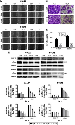 Figure 3 TBMS1 suppressed migration of OSCC cells in vitro.