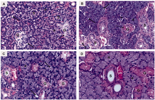 Figure 4. A photomicrograph of rat submandibular salivary gland showing (A) group I (DM): blurred acinar boundaries (a), massive vacuolization (arrows), degenerated granular convoluted tubule (G), ductal cell vacuolization (dotted arrow), striated duct with loss of basal cell boundary (S). (B) Group II (DM + OE): well defined acini (a), acinar vacuolization (arrows), absence of acinar configuration (asterisk), GCTs (G), clumped eosinophilic granules (dotted arrow), ductal vacuolization (curved arrow), striated ducts (S). (C) Group III (DM + OE-NC3): uniformly arranged acini (a), discrete vacuolization (arrows), GCTs (G), striated ducts (S). (D) Group IV (DM + OE-NC4): normal ductal parenchymal elements; acini (a), GCTs (G), striated ducts (S) (H&E, Orig. Mag. ×400).