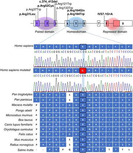 Figure 1 Diagrammatic representation of PAX4 gene and protein domains. Pathogenic mutations described associated to diabetes mellitus are pointed in the figure and PAX4-MODY are show in bold. Electropherograms of PAX4 exon 4 wild type and p.Arg164Gln (c.491G>A) in the patient DM35. Alignment by Clustal W (1.81) of PAX4 gene across species are presented (below).