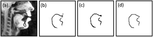 Figure 1. Example of post-processing steps. (a) Initial image. (b) Predicted probability map. (c) Result of thresholding application (decision threshold set to 0.4 for this illustration). (d) Result of the final post-processing
