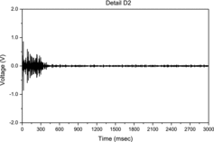 Figure 7. Detail D2 (level 2 high-frequency decomposition of the signal using Haar wavelet).