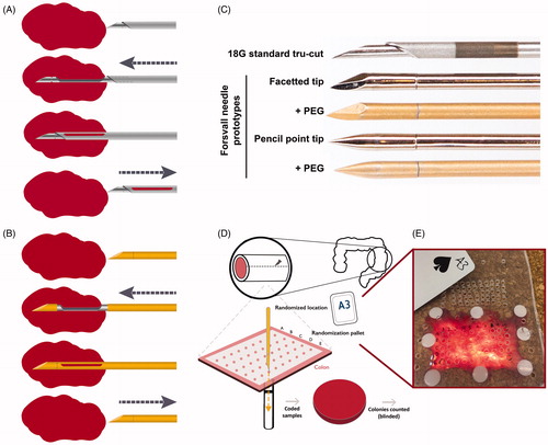 Figure 1. Ex vivo biopsy simulation method with standard needle and Forsvall needle prototypes. (A) Schematic depiction of standard Tru-Cut biopsy needle mechanism. (B) Schematic depiction of Forsvall needle biopsy mechanism. (C) The five needles used in the ex vivo simulation were a standard 18 G Tru-Cut needle (Bard) and four versions of the Forsvall 18 G stainless steel needle prototype: Facetted tip with no coating, facetted tip with gold + PEG coating, pencil point tip with no coating, and pencil point tip with gold + PEG coating. Note that the opening of the Tru-Cut needle is in the direction of travel, the opening of the Forsvall needle is in a 90-degree angle to the direction of travel. In the ex-vivo simulation the needles were used in this same order until all punctures were completed. (D) Schematic depiction of the experimental workflow. First, fresh colons were obtained after colon cancer surgery and opened to form a 5 × 8cm rectangle. This rectangular piece of colon was then mounted on a special bracket with the mucosal side up. A randomization pallet consisting of 50 evenly spaced holes labelled A–E and 1–10 was mounted over the colon. A card was drawn from a randomization deck of playing cards with labels corresponding to the holes on the randomization pallet. The corresponding hole was then punctured with the next needle in the series. The needle was immediately submerged in a tube filled with culture media to a depth of 6 cm, opened and closed to dislodge any collected material, and then removed. The culture media was plated on a code-labelled blood agar plate and incubated overnight, and the number of colonies was counted blindly to avoid bias. (E) Photograph of a colon mounted on the bracket with the randomization pallet placed on top, as viewed from above.