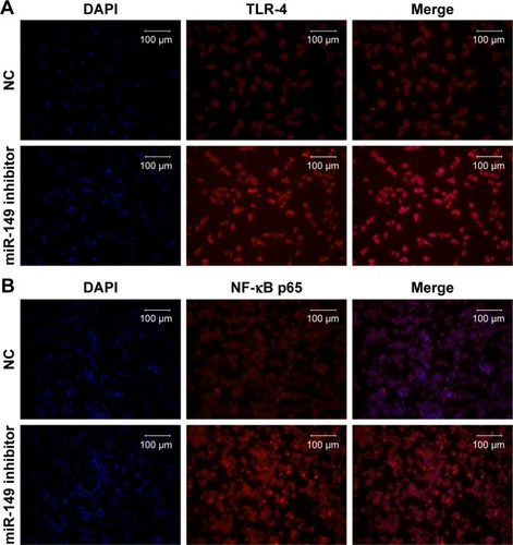 Figure 5 The protein expression level of TLR-4 (A) and NF-κB p65 (B) in THP-1 cells transfected with NC or miR-149-3p inhibitors was detected by the immunofluorescence assay.